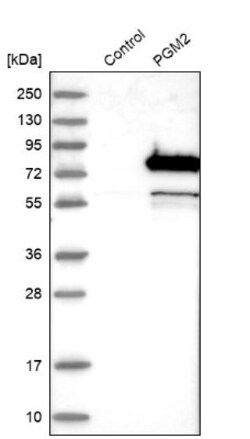 PGM2 Antibody, Novus Biologicals 25 &mu;L, Unlabeled:Antibodies, Polyclonal